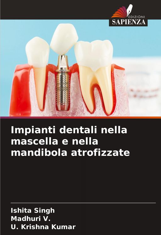 Produktbild: Impianti dentali nella mascella e nella mandibola atrofizzate