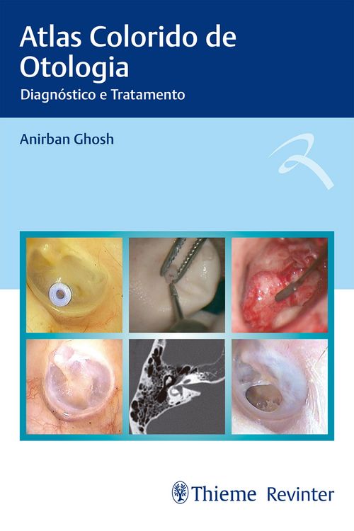 Produktbild: Atlas Colorido de Otologia