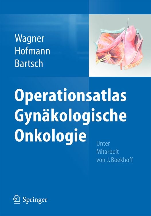 Produktbild: Operationsatlas Gyn&auml;kologische Onkologie