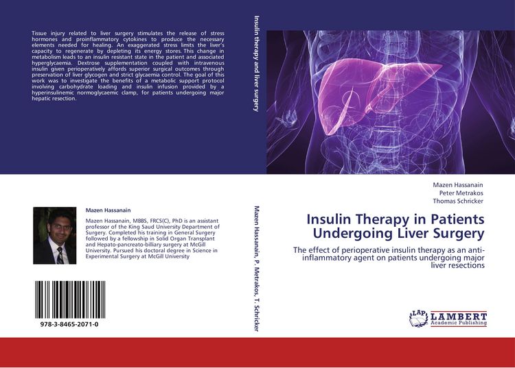 Produktbild: Insulin Therapy in Patients Undergoing Liver Surgery