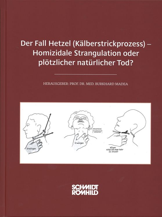 Produktbild: Der Fall Hetzel (K&auml;lberstrickprozess) - Homizidale Strangulation oder pl&ouml;tzlicher nat&uuml;rlicher Tod?