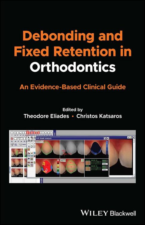 Produktbild: Debonding and Fixed Retention in Orthodontics