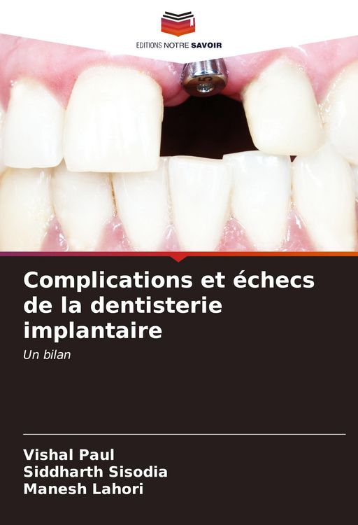 Produktbild: Complications et &eacute;checs de la dentisterie implantaire