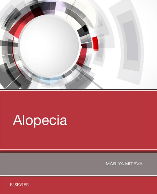 Produktbild: Alopecia