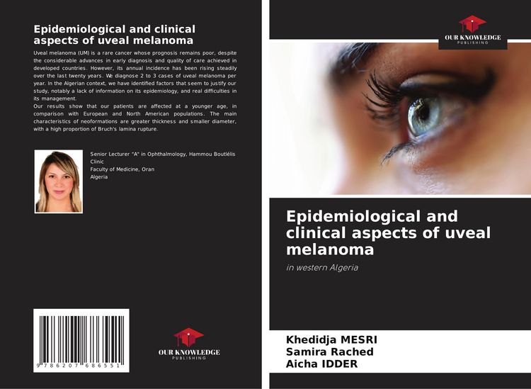 Produktbild: Epidemiological and clinical aspects of uveal melanoma