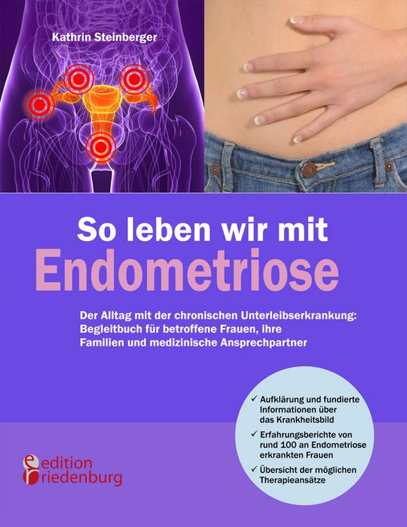 Produktbild: So leben wir mit Endometriose - Der Alltag mit der chronischen Unterleibserkrankung: Begleitbuch f&uuml;r betroffene Frauen, ihre Familien und medizinische Ansprechpartner