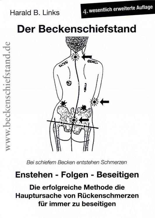 Produktbild: Der Beckenschiefstand
