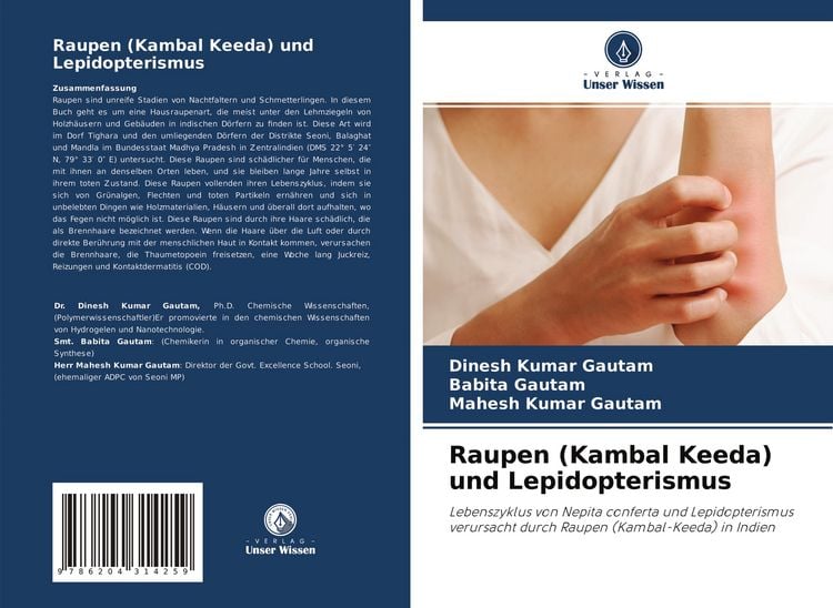 Produktbild: Raupen (Kambal Keeda) und Lepidopterismus