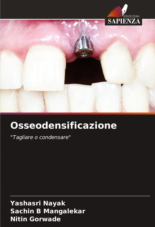 Produktbild: Osseodensificazione