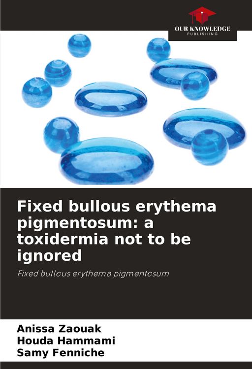 Produktbild: Fixed bullous erythema pigmentosum: a toxidermia not to be ignored