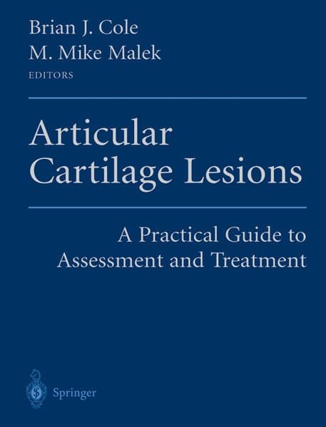 Produktbild: Articular Cartilage Lesions