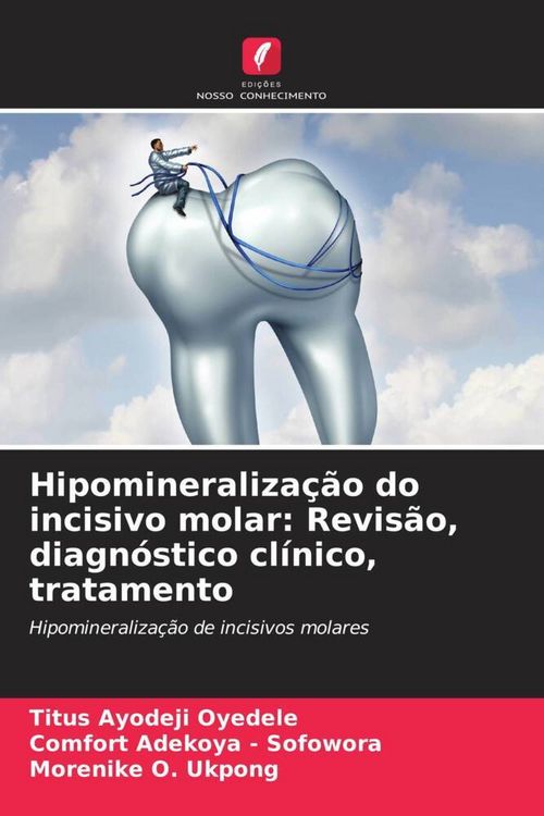 Produktbild: Hipomineraliza&ccedil;&atilde;o do incisivo molar: Revis&atilde;o, diagn&oacute;stico cl&iacute;nico, tratamento