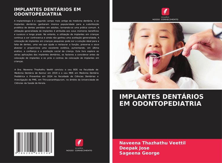 Produktbild: Implantes Dent&aacute;rios Em Odontopediatria