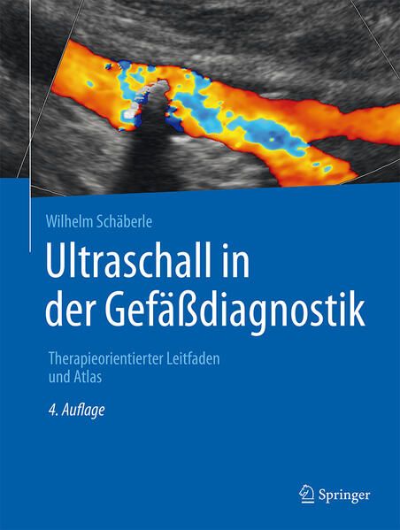 Produktbild: Ultraschall in der Gef&auml;&szlig;diagnostik