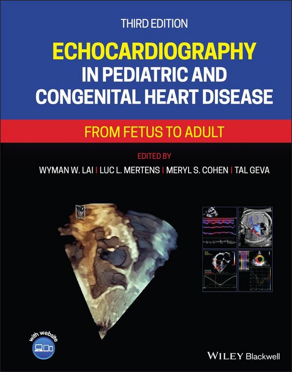 Produktbild: Echocardiography in Pediatric and Congenital Heart Disease