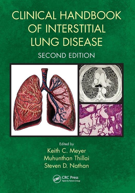 Produktbild: Clinical Handbook of Interstitial Lung Disease
