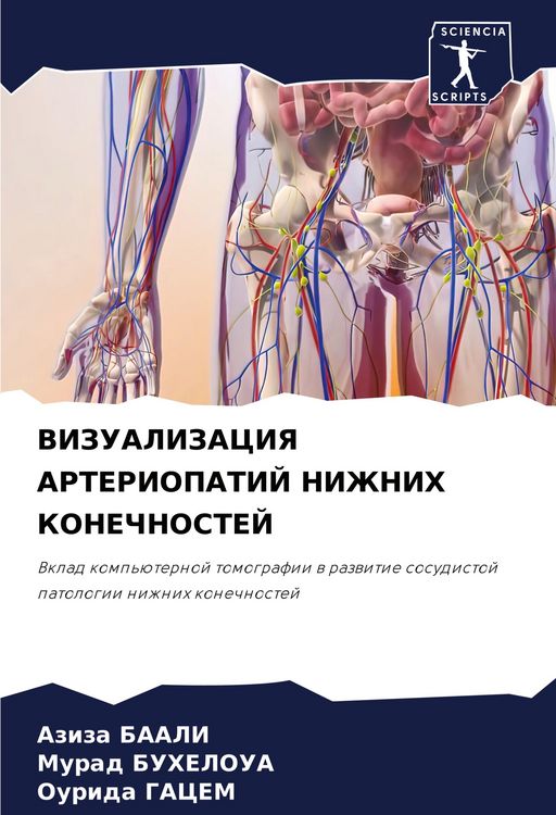 Produktbild: Vizualizaciya Arteriopatij Nizhnih Konechnostej
