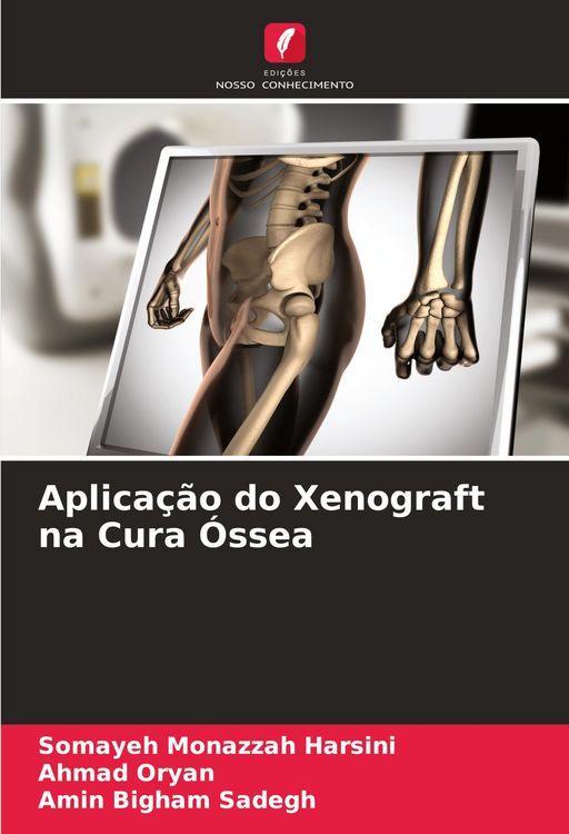 Produktbild: Aplica&ccedil;&atilde;o do Xenograft na Cura &Oacute;ssea