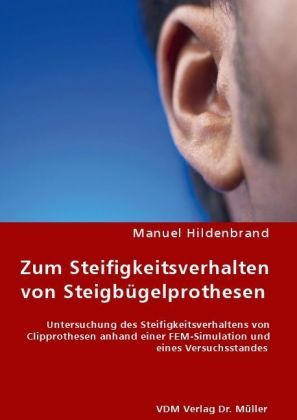 Produktbild: Zum Steifigkeitsverhalten von Steigb&uuml;gelprothesen