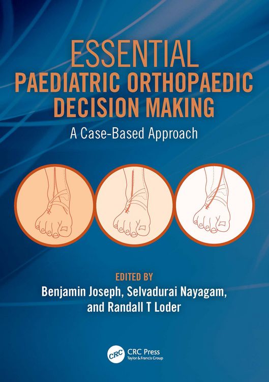 Produktbild: Essential Paediatric Orthopaedic Decision Making