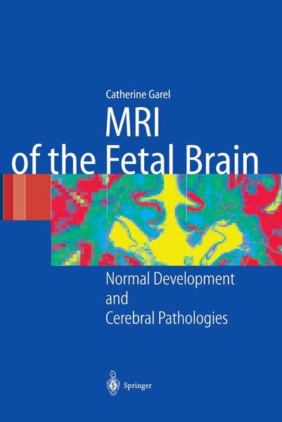 Produktbild: MRI of the Fetal Brain