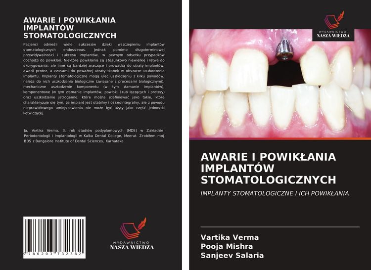 Produktbild: AWARIE I POWIK&iquest;ANIA IMPLANT&Oacute;W STOMATOLOGICZNYCH