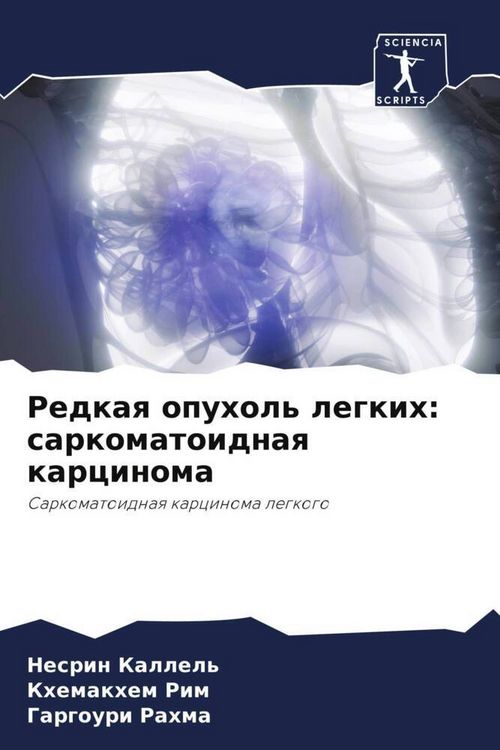 Produktbild: Redkaq opuhol' legkih: sarkomatoidnaq karcinoma