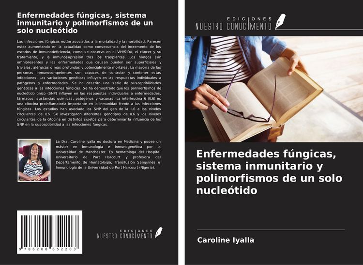 Produktbild: Enfermedades f&uacute;ngicas, sistema inmunitario y polimorfismos de un solo nucle&oacute;tido