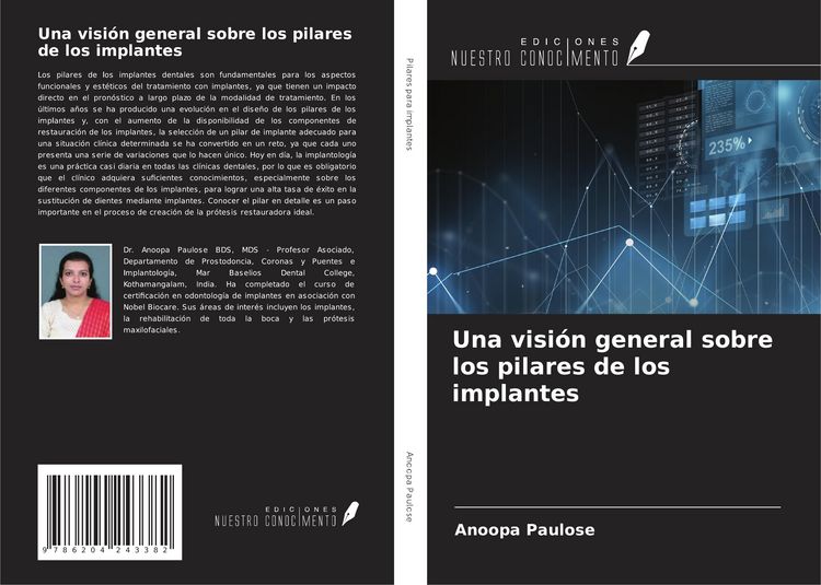 Produktbild: Una visi&oacute;n general sobre los pilares de los implantes