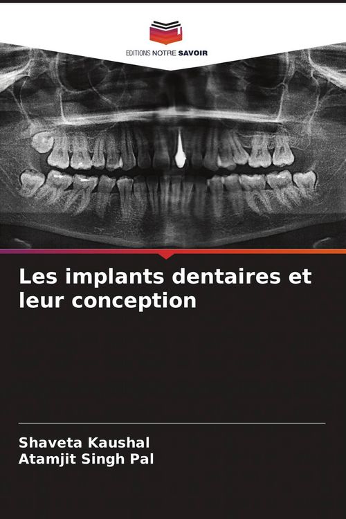Produktbild: Les implants dentaires et leur conception