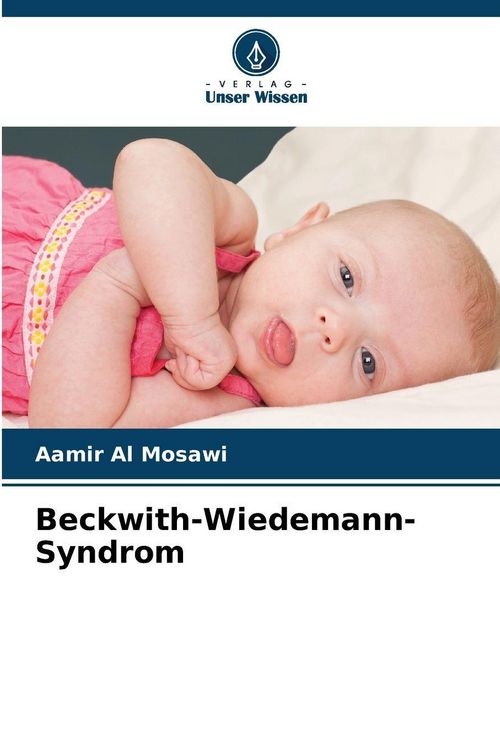 Produktbild: Beckwith-Wiedemann-Syndrom