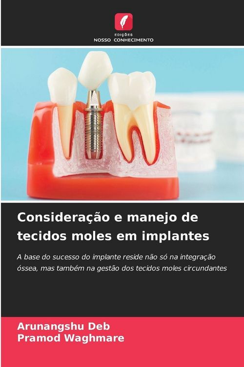 Produktbild: Considera&ccedil;&atilde;o e manejo de tecidos moles em implantes