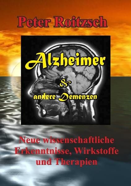 Produktbild: Alzheimer &amp; andere Demenzen