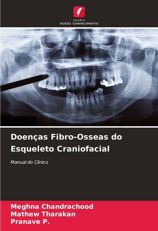 Produktbild: Doen&ccedil;as Fibro-Osseas do Esqueleto Craniofacial