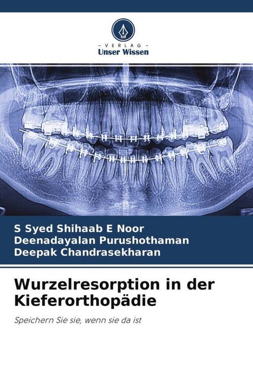 Produktbild: Wurzelresorption in der Kieferorthop&auml;die