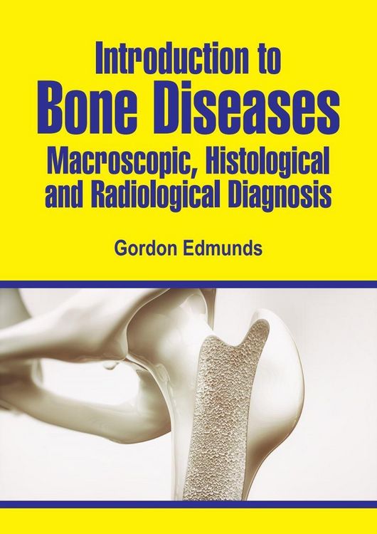 Produktbild: Introduction to Bone Diseases