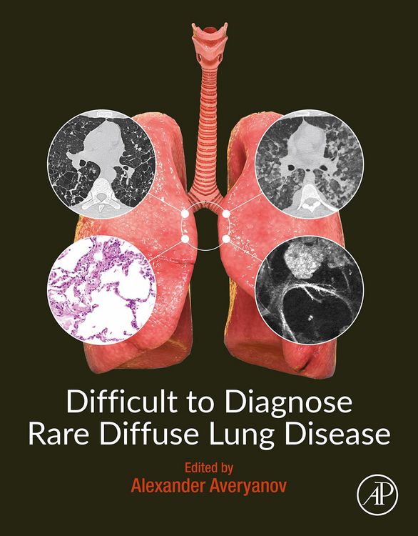 Produktbild: Difficult to Diagnose Rare Diffuse Lung Disease