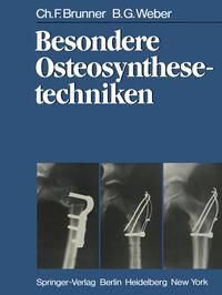 Produktbild: Besondere Osteosynthesetechniken