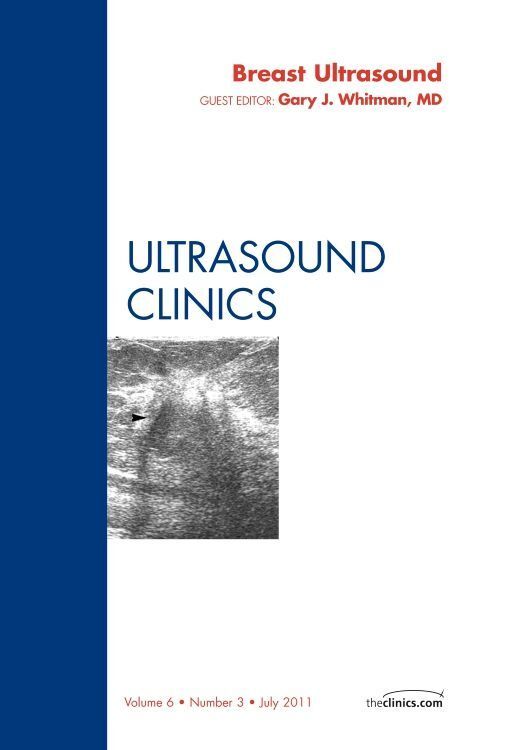 Produktbild: Breast Ultrasound, an Issue of Ultrasound Clinics