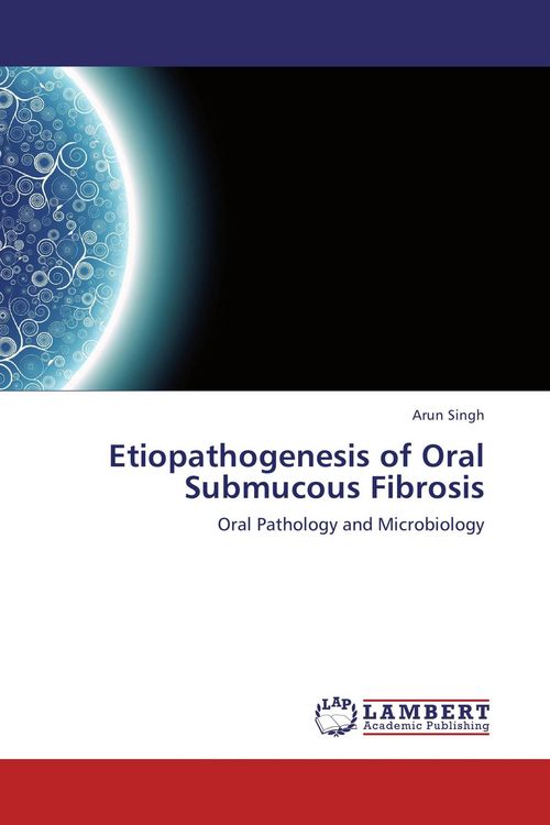 Produktbild: Etiopathogenesis of Oral Submucous Fibrosis