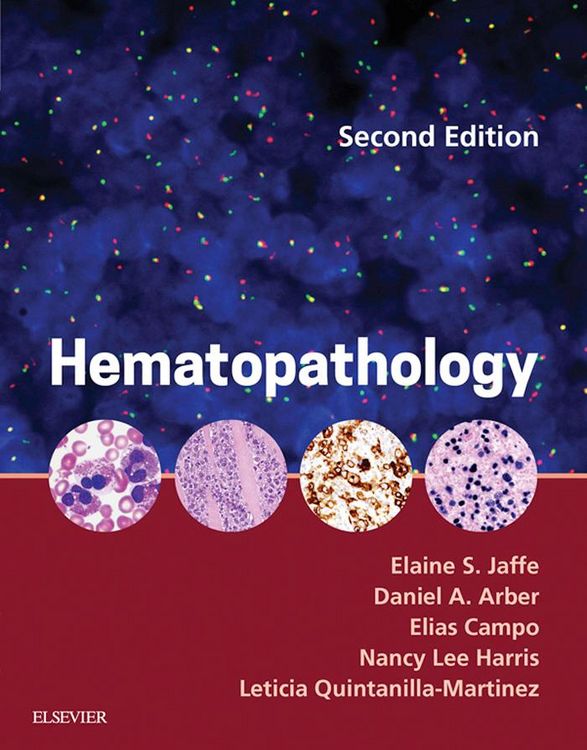 Produktbild: Hematopathology E-Book