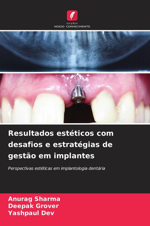Produktbild: Resultados est&eacute;ticos com desafios e estrat&eacute;gias de gest&atilde;o em implantes