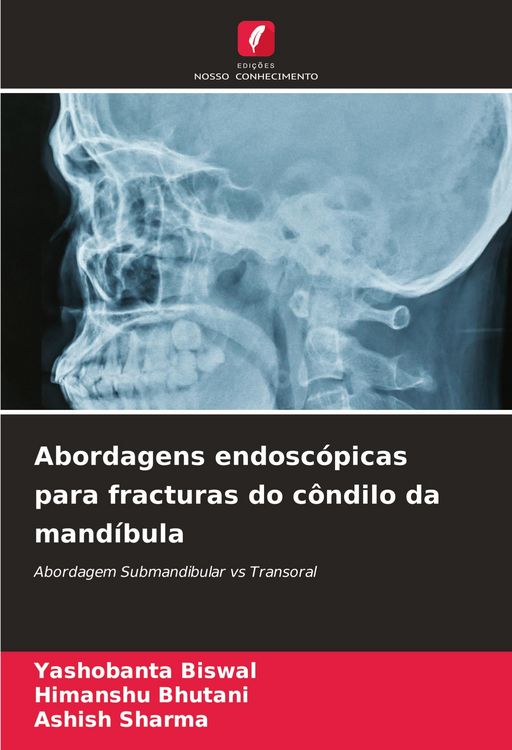 Produktbild: Abordagens endosc&oacute;picas para fracturas do c&ocirc;ndilo da mand&iacute;bula