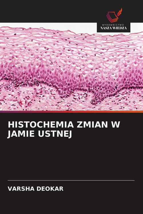 Produktbild: Histochemia Zmian W Jamie Ustnej