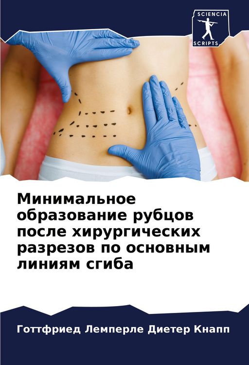 Produktbild: Minimal'noe obrazowanie rubcow posle hirurgicheskih razrezow po osnownym liniqm sgiba