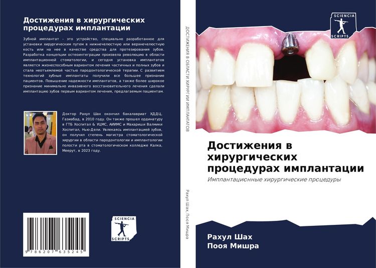 Produktbild: Dostizheniq w hirurgicheskih procedurah implantacii