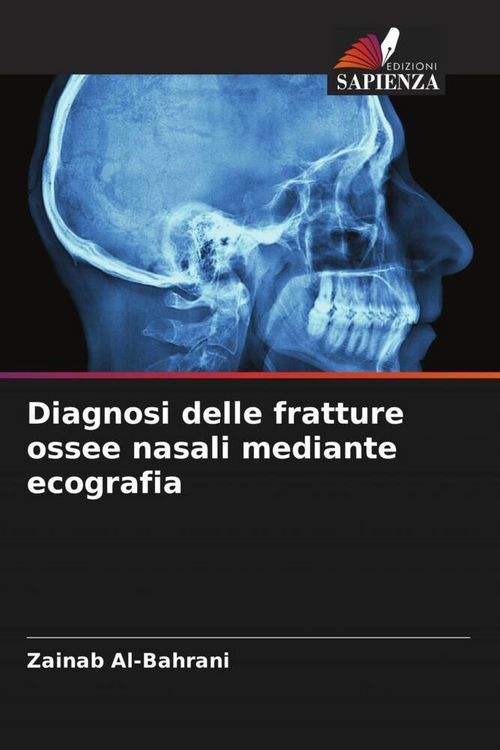 Produktbild: Diagnosi delle fratture ossee nasali mediante ecografia
