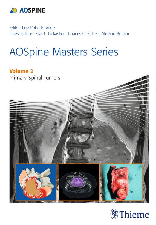 Produktbild: AOSpine Masters Series Volume 2: Primary Spinal Tumors
