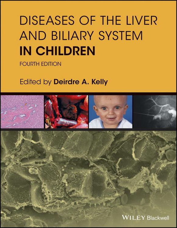 Produktbild: Diseases of the Liver and Biliary System in Children