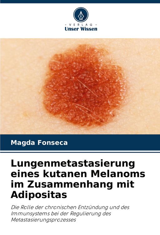 Produktbild: Lungenmetastasierung eines kutanen Melanoms im Zusammenhang mit Adipositas